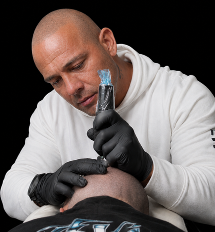 SMP hair tattoo behandeling in Lelystad door Mark